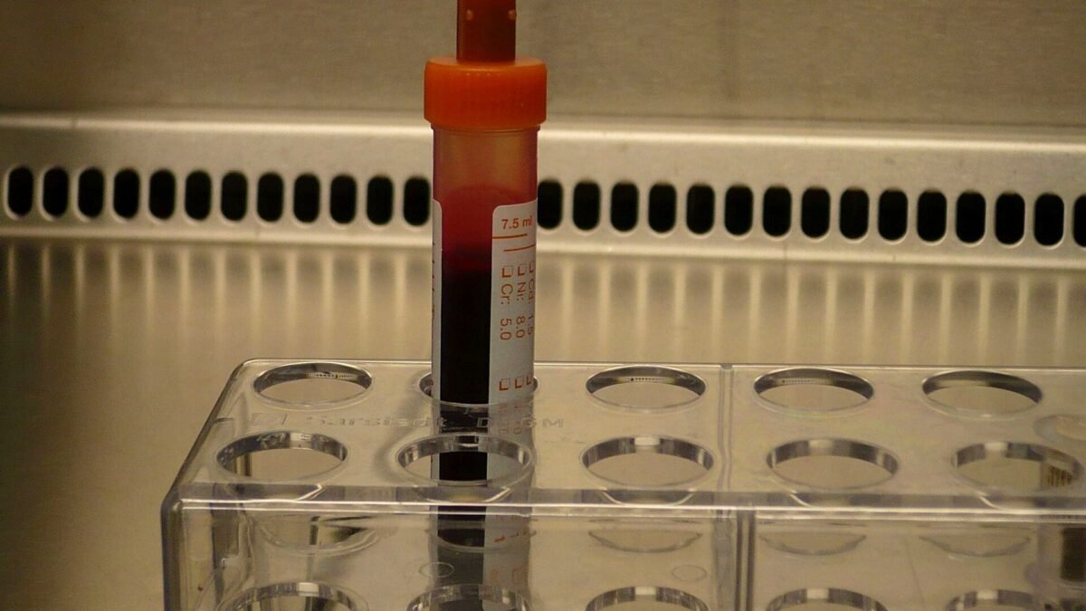 A blood sample tube in a laboratory rack — the new Alzheimer's blood tests detect p-tau217 in a routine blood draw.