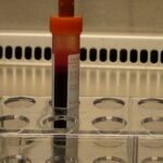 A blood sample tube in a laboratory rack — the new Alzheimer's blood tests detect p-tau217 in a routine blood draw.
